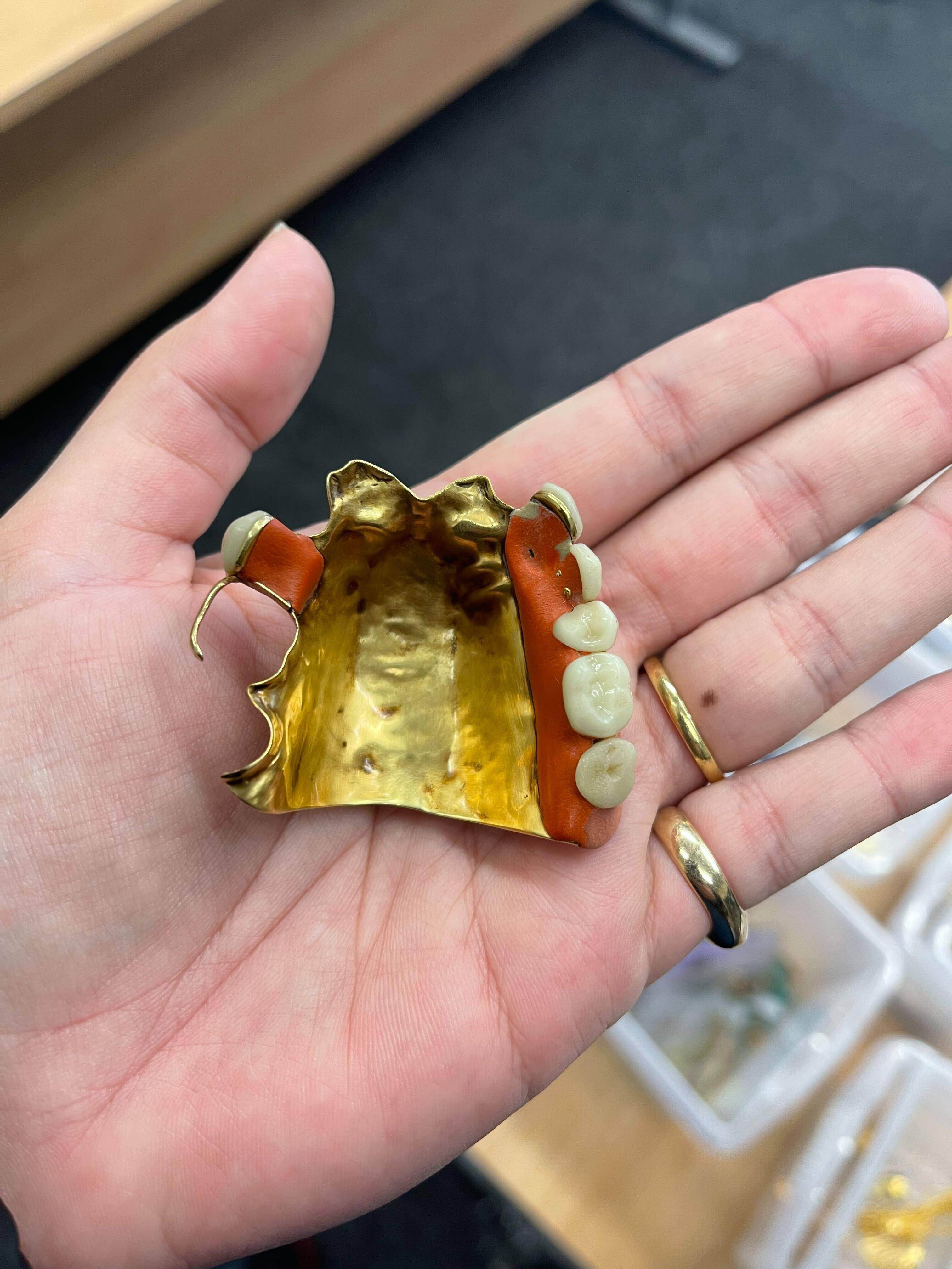 Golden false teeth